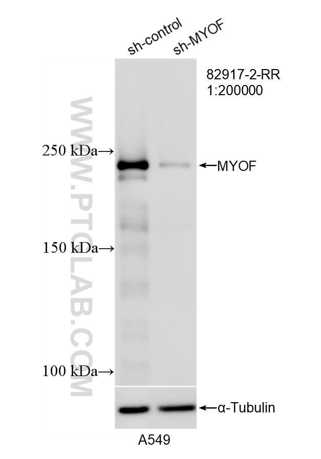 WB result of MYOF antibody (82917-2-RR; 1:200000; incubated at room temperature for 1.5 hours) with sh-Control and sh-MYOF transfected A549 cells. WB analysis of A549 using 82917-2-RR