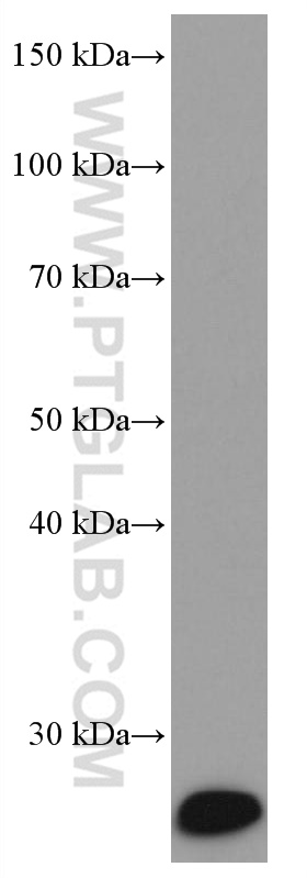 WB analysis of human skeletal muscle using 67082-1-Ig