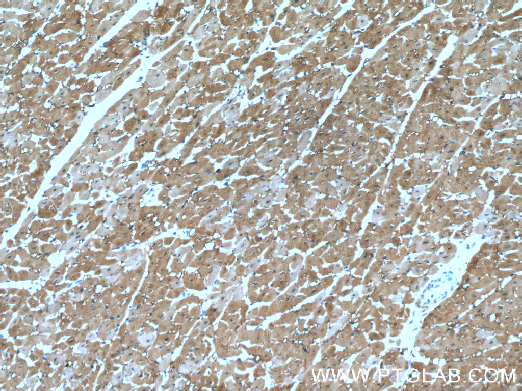 IHC staining of human heart using 66205-1-Ig (same clone as 66205-1-PBS)