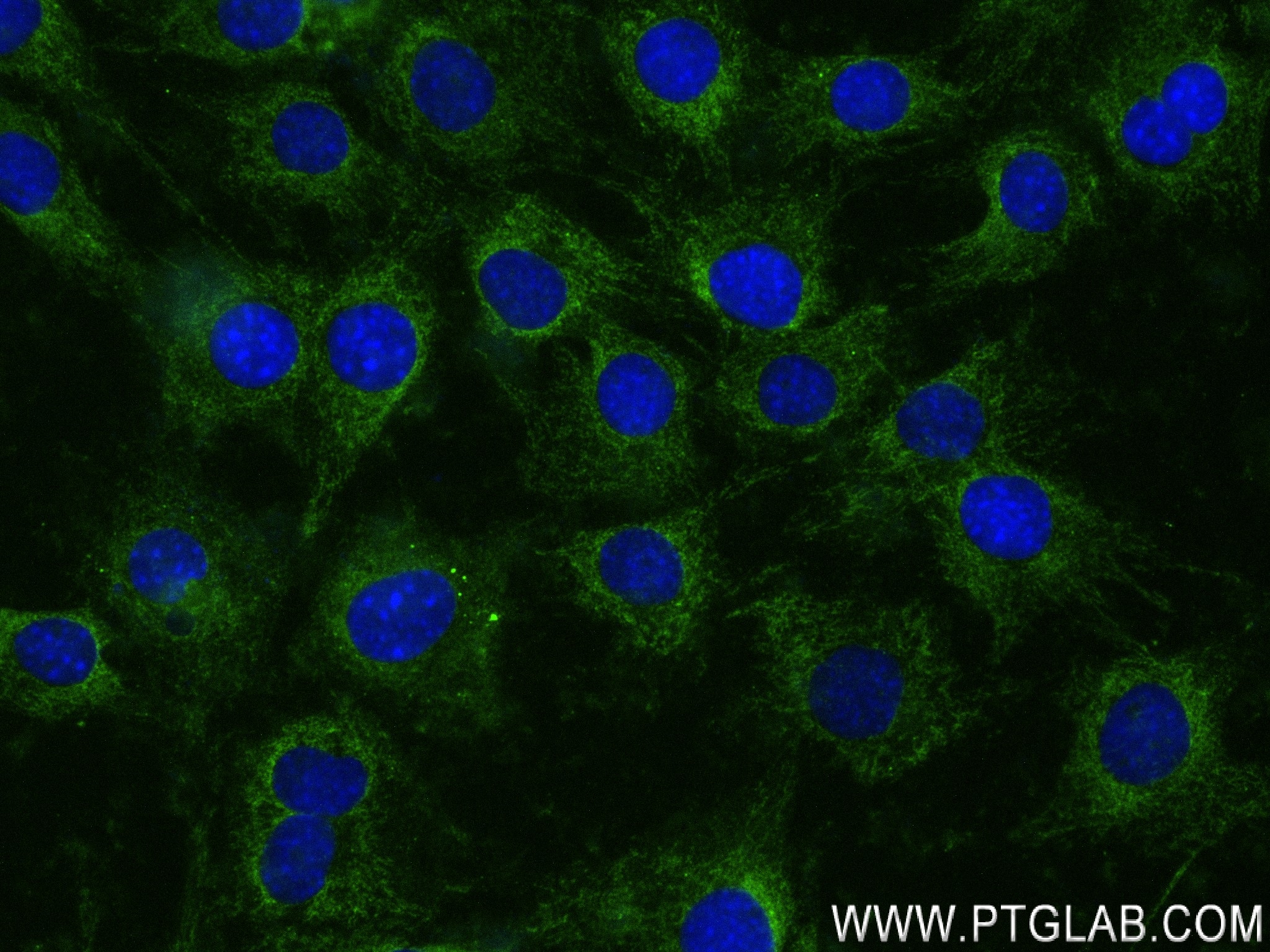 IF Staining of C2C12 using 84099-1-RR