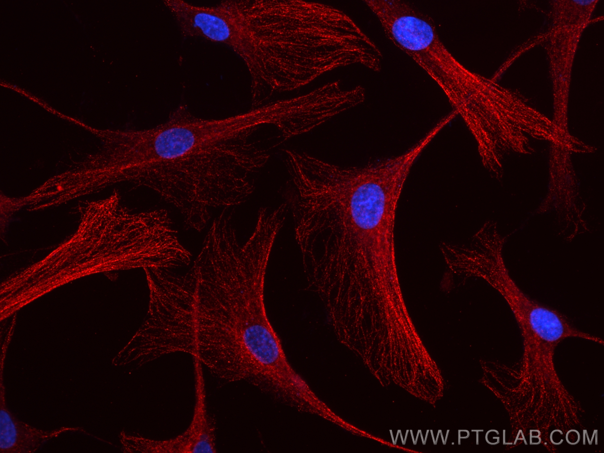 IF Staining of HSkMC using 84099-1-RR