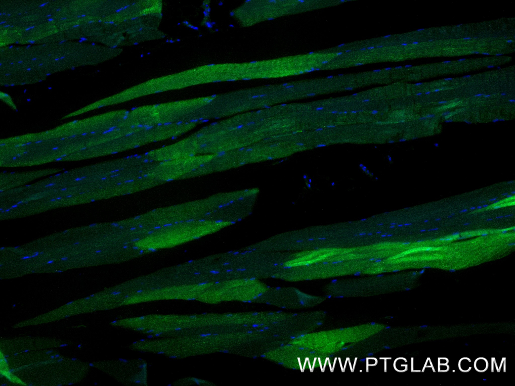IF Staining of human skeletal muscle using 84099-1-RR IF Staining of human skeletal muscle using 84099-1-RR