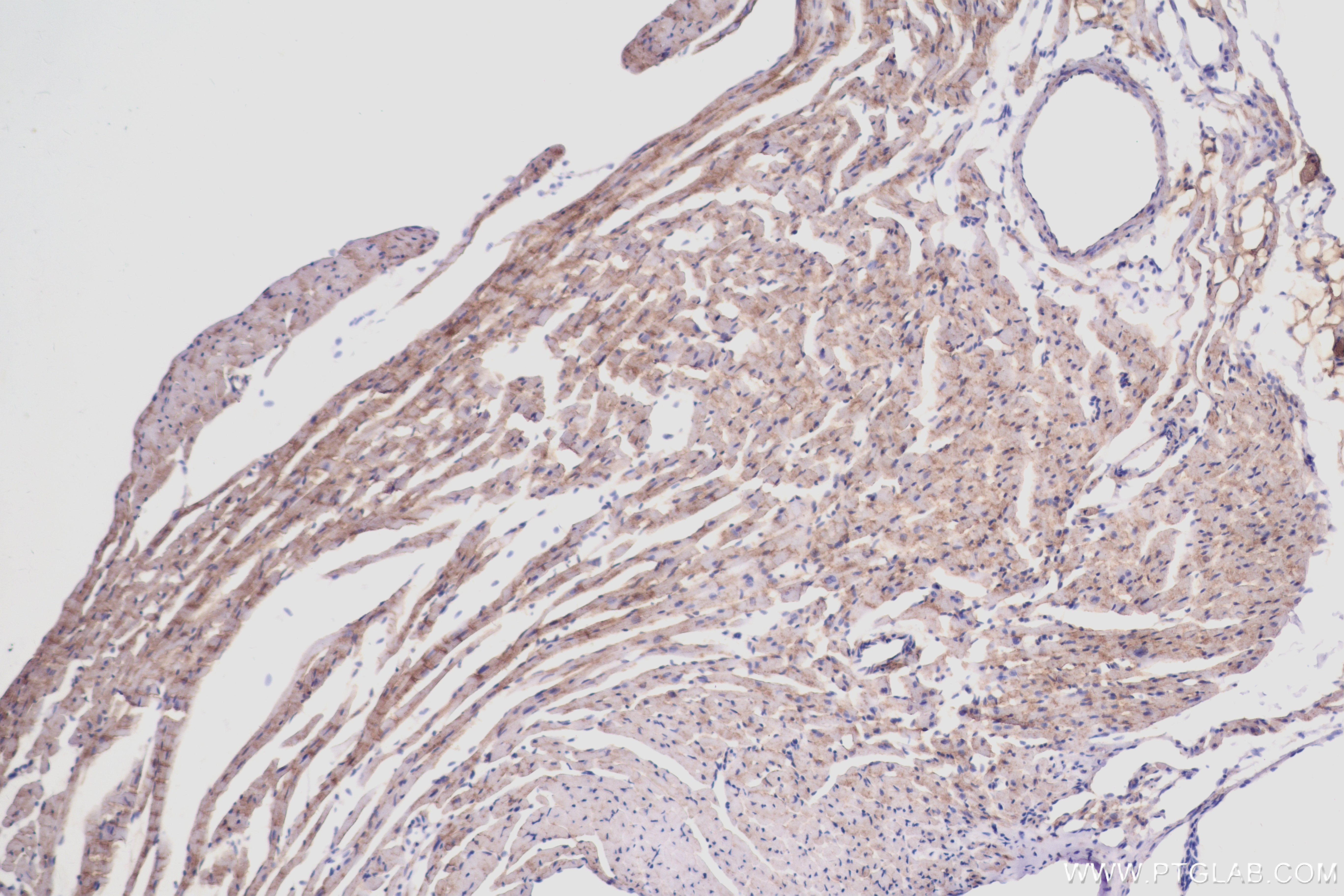 IHC staining of mouse heart using 84099-1-RR