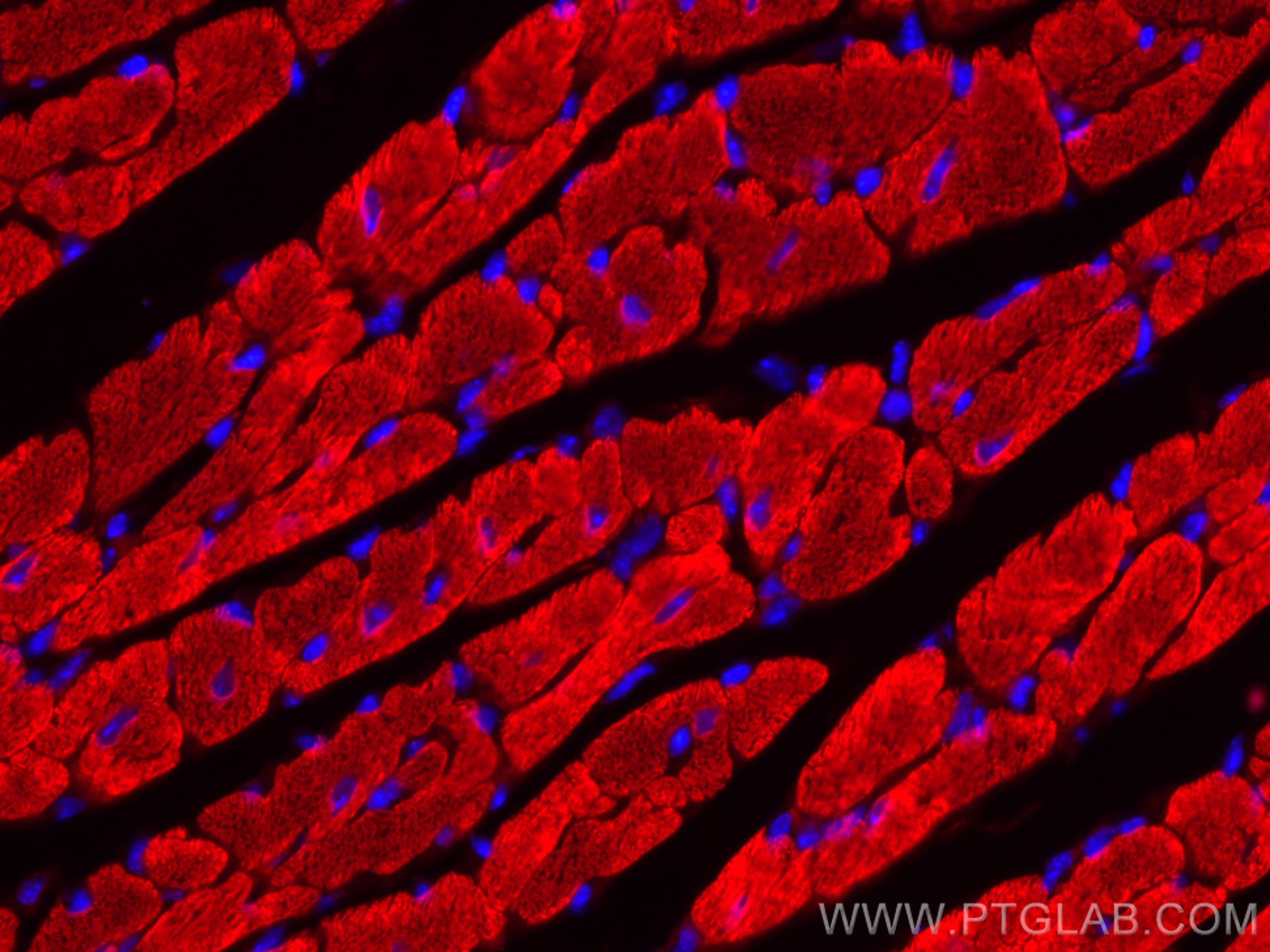 Myosin Light Chain 2/MLC-2V