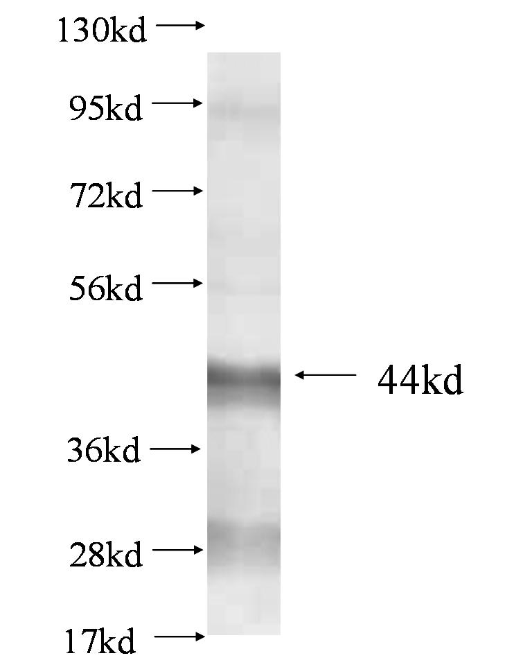 N/A fusion protein Ag0851 SDS-PAGE