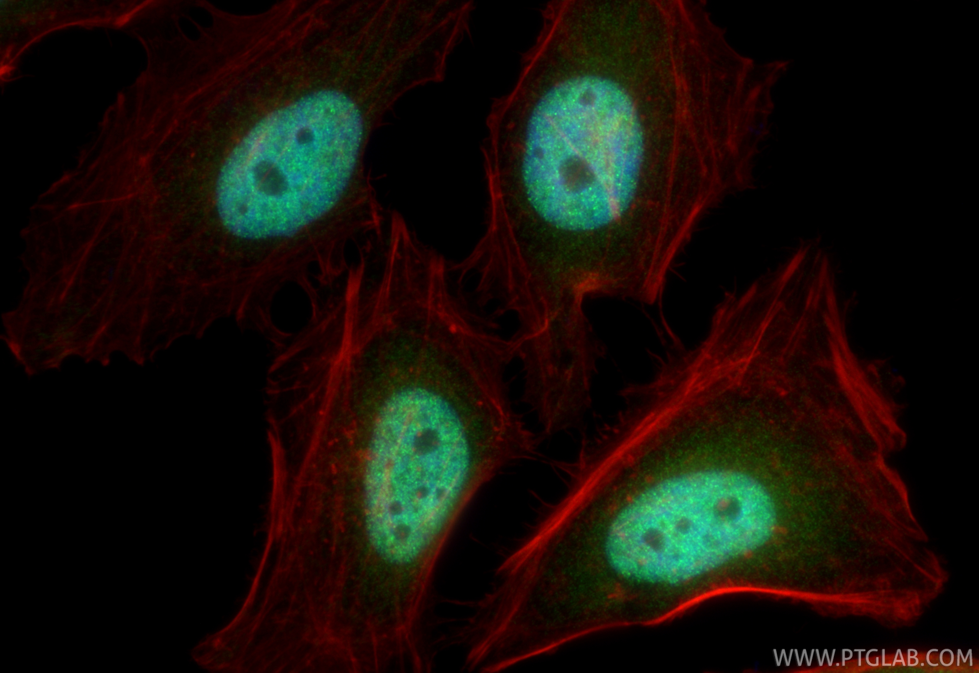 IF Staining of HeLa using 14833-1-AP IF Staining of HeLa using 14833-1-AP
