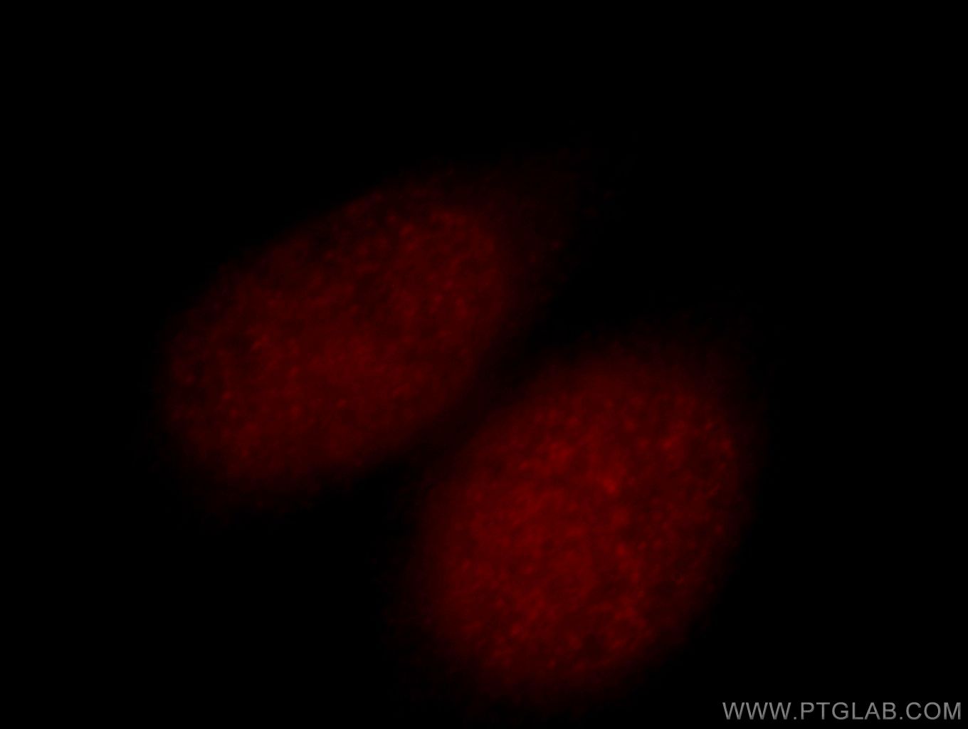 IF Staining of HeLa using 14833-1-AP