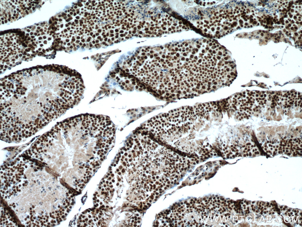 IHC staining of mouse testis using 14833-1-AP