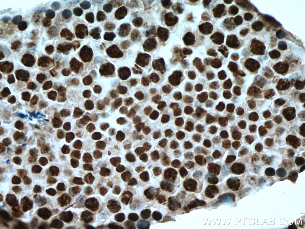 IHC staining of mouse testis using 14833-1-AP