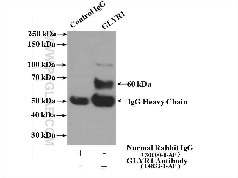 IP experiment of K-562 using 14833-1-AP