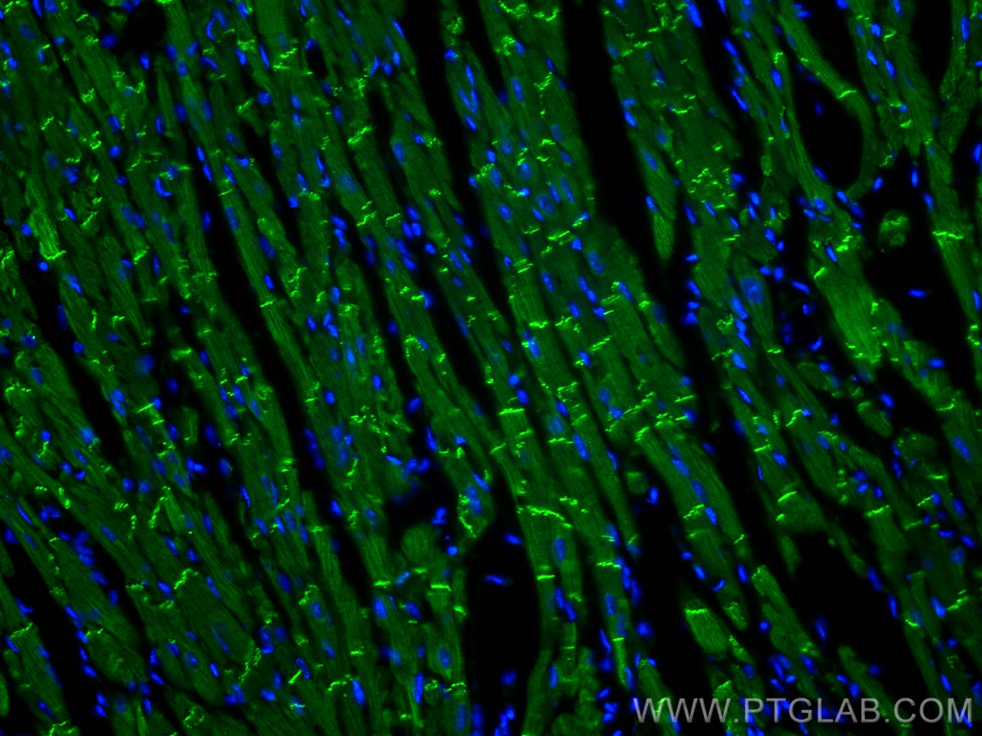 IF Staining of mouse heart using 22018-1-AP