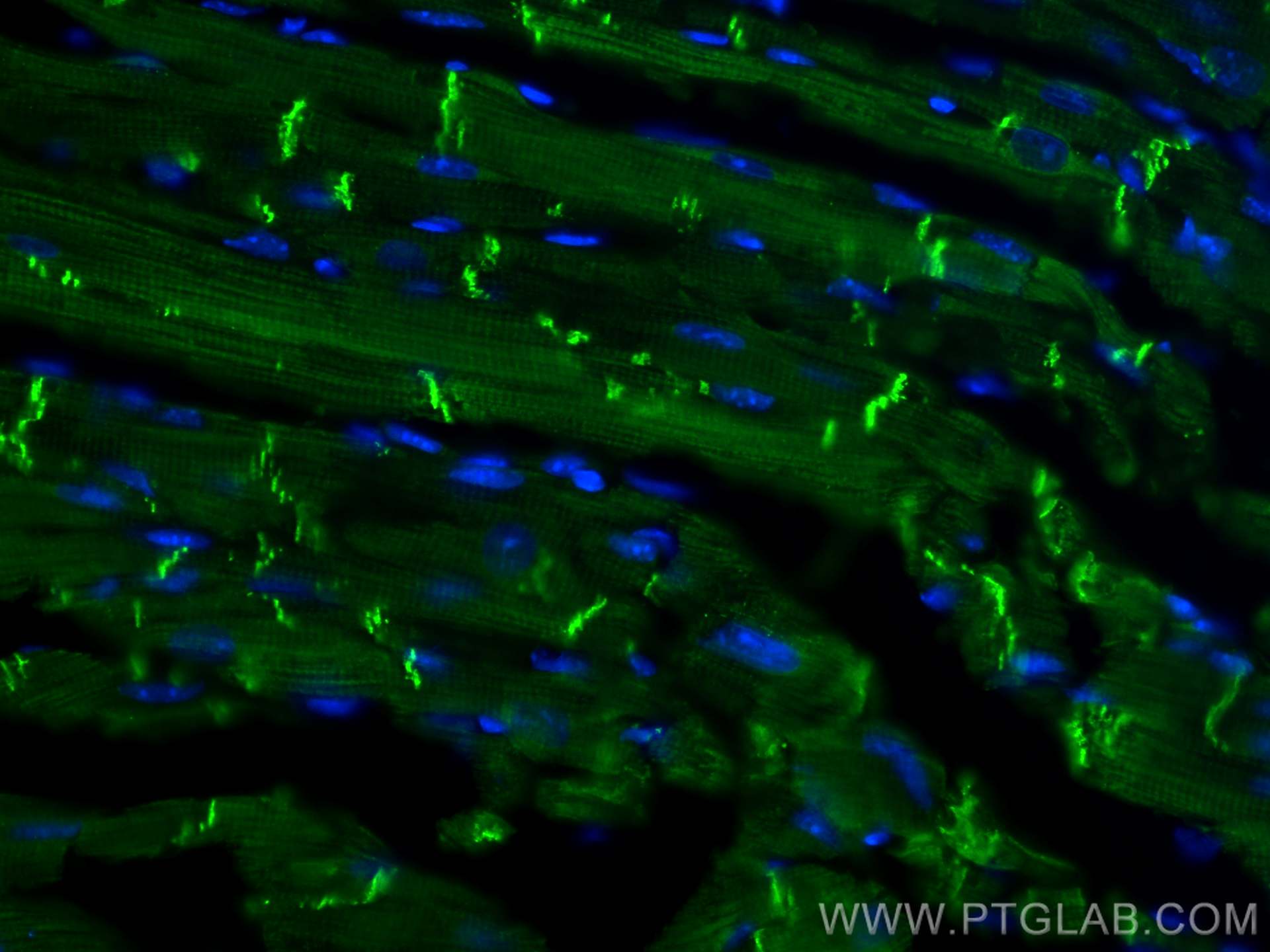 IF Staining of mouse heart using 22018-1-AP