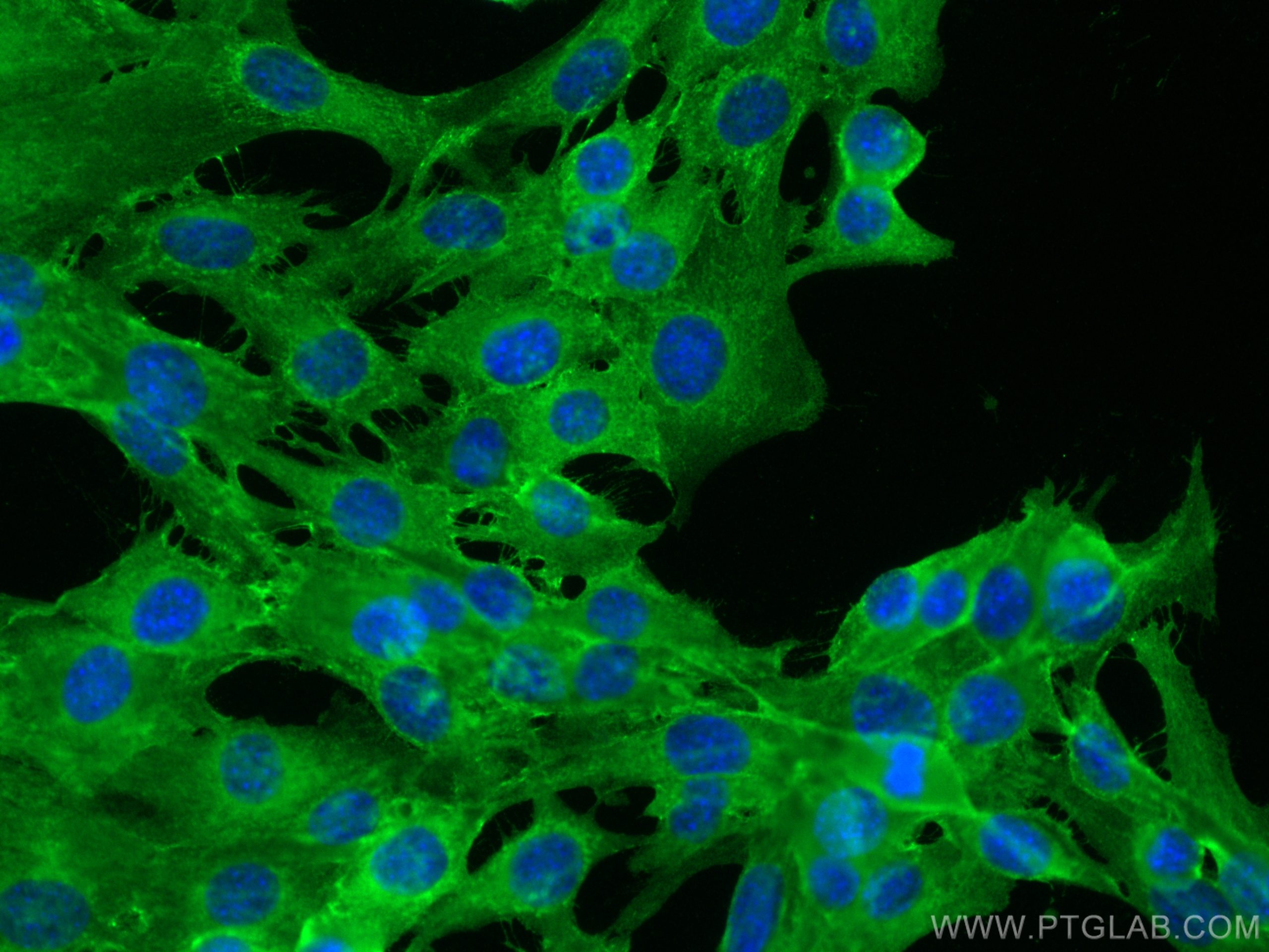 IF Staining of C2C12 using 22018-1-AP