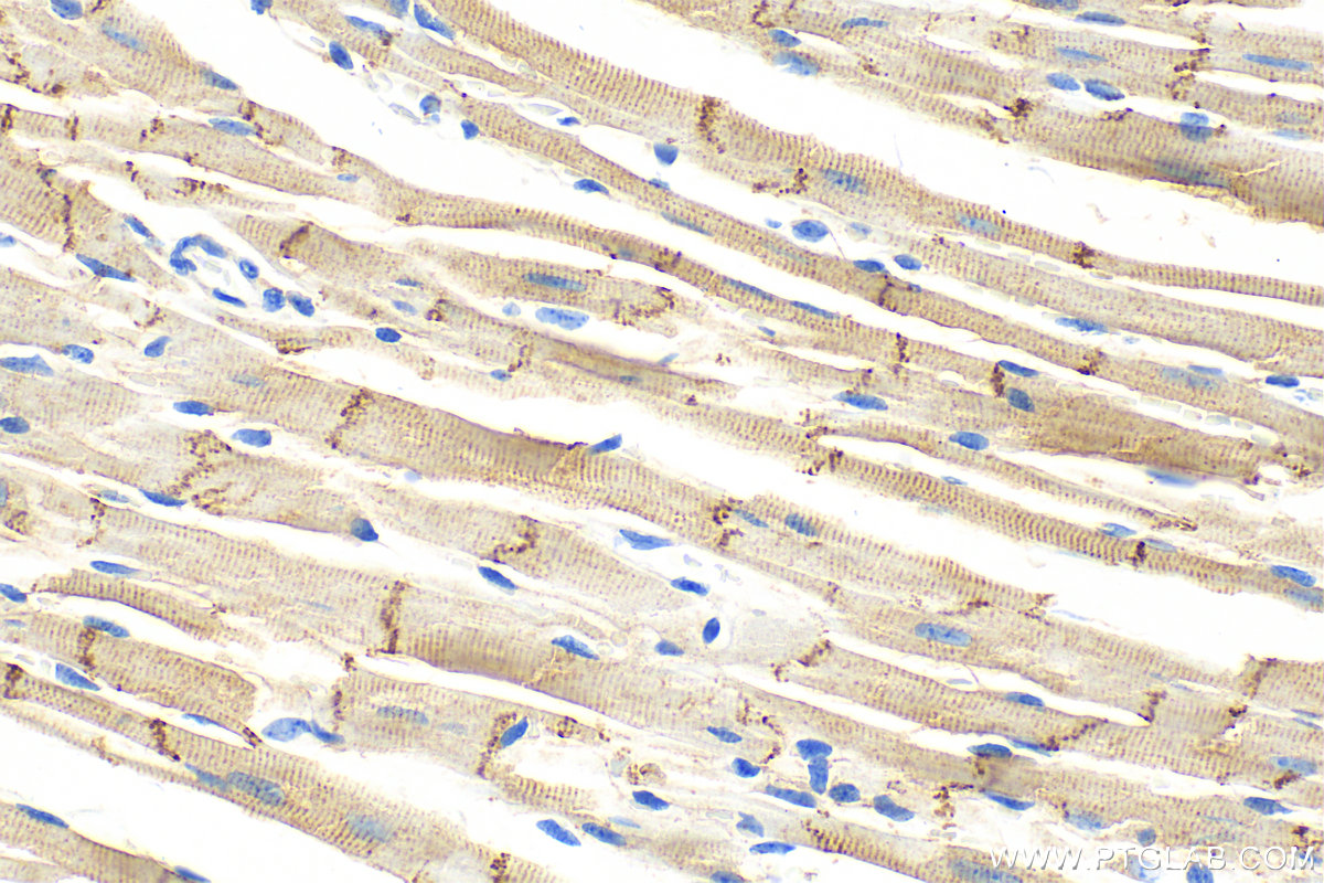 IHC staining of mouse heart using 22018-1-AP