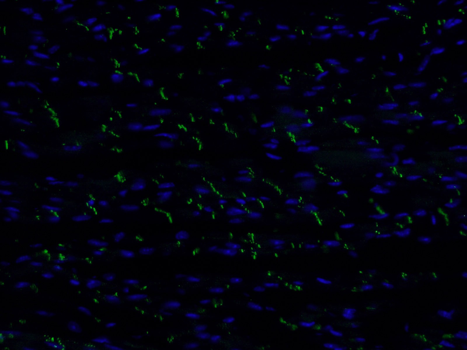 N-cadherin