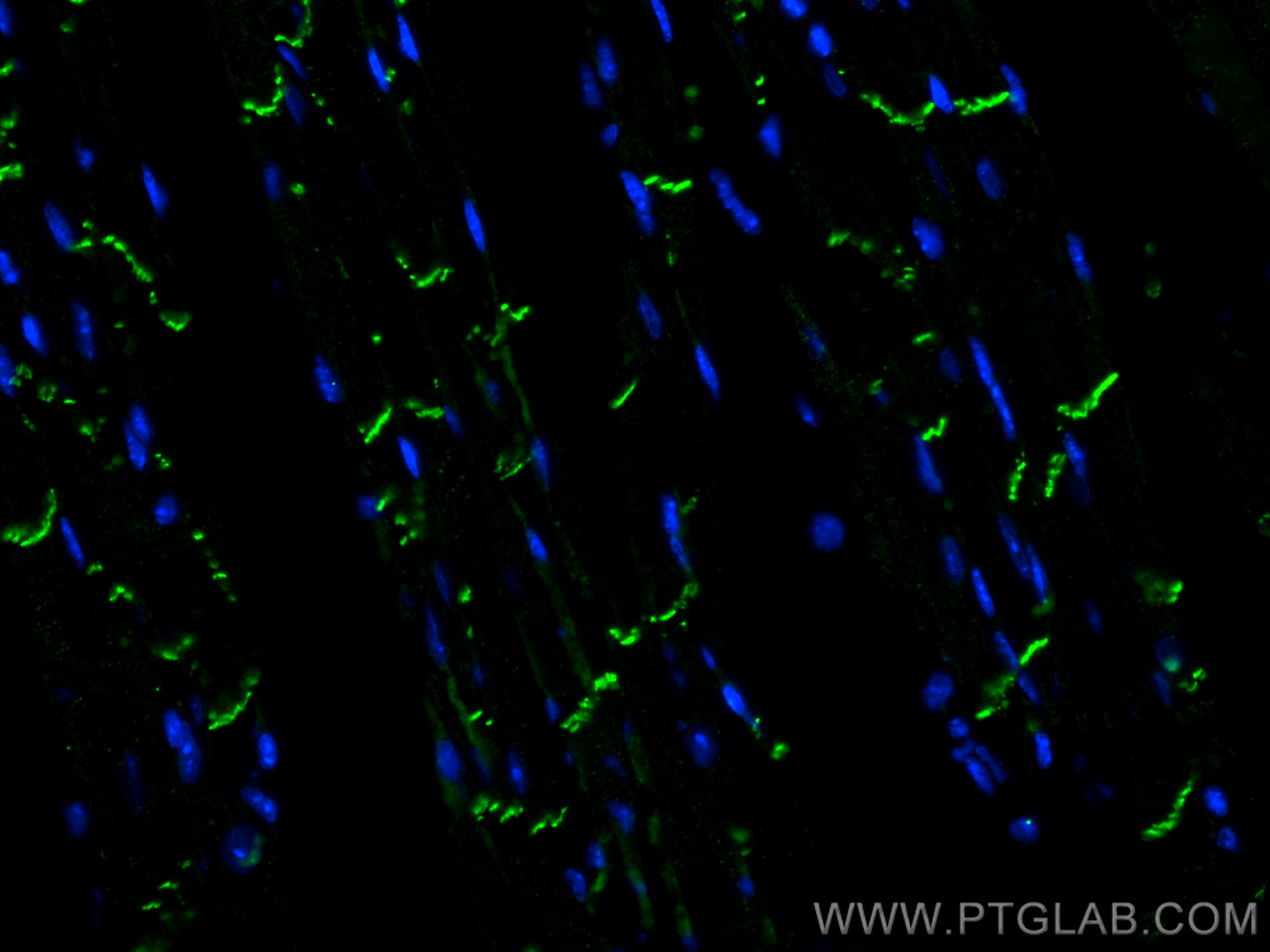 IF Staining of mouse heart using 66219-1-Ig (same clone as 66219-1-PBS)