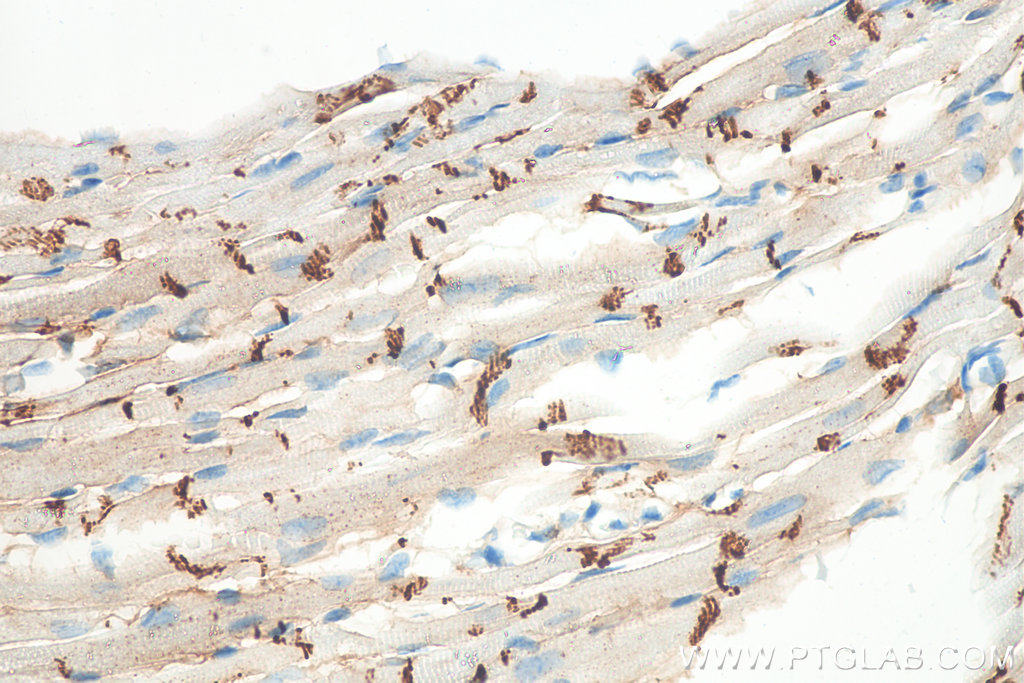 IHC staining of mouse heart using 66219-1-Ig (same clone as 66219-1-PBS)