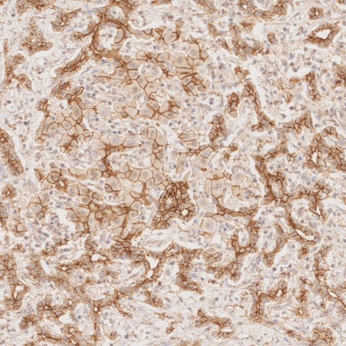 IHC staining of human liver using 66219-1-Ig IHC staining of human liver using 66219-1-Ig