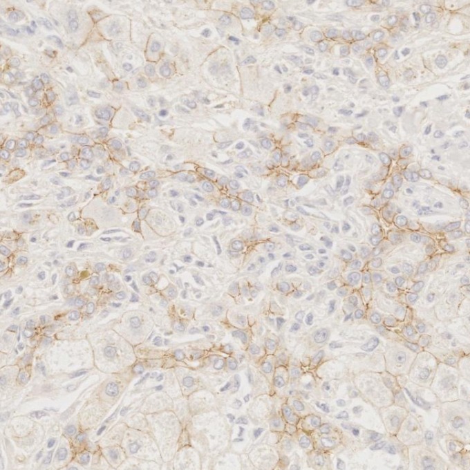IHC staining of human liver using 66219-1-Ig IHC staining of human liver using 66219-1-Ig