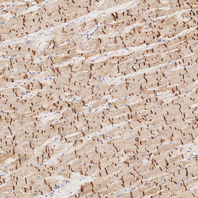 IHC staining of human heart using 66219-1-Ig IHC staining of human heart using 66219-1-Ig