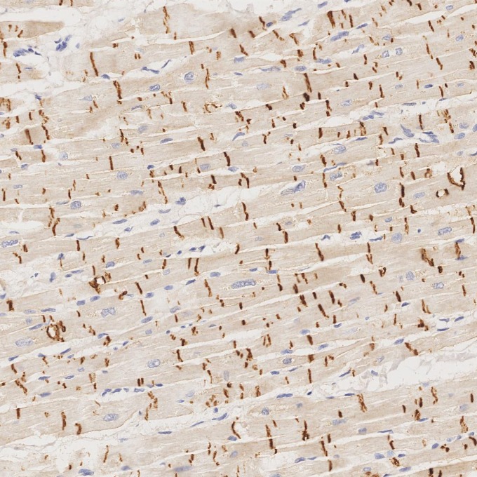 IHC staining of human heart using 66219-1-Ig IHC staining of human heart using 66219-1-Ig