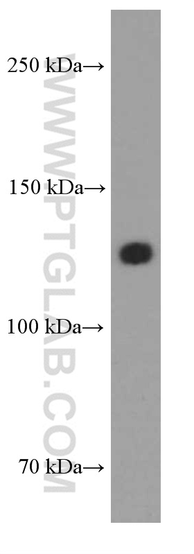 N-cadherin Monoclonal antibody