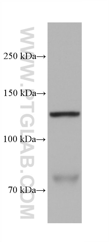 N-cadherin