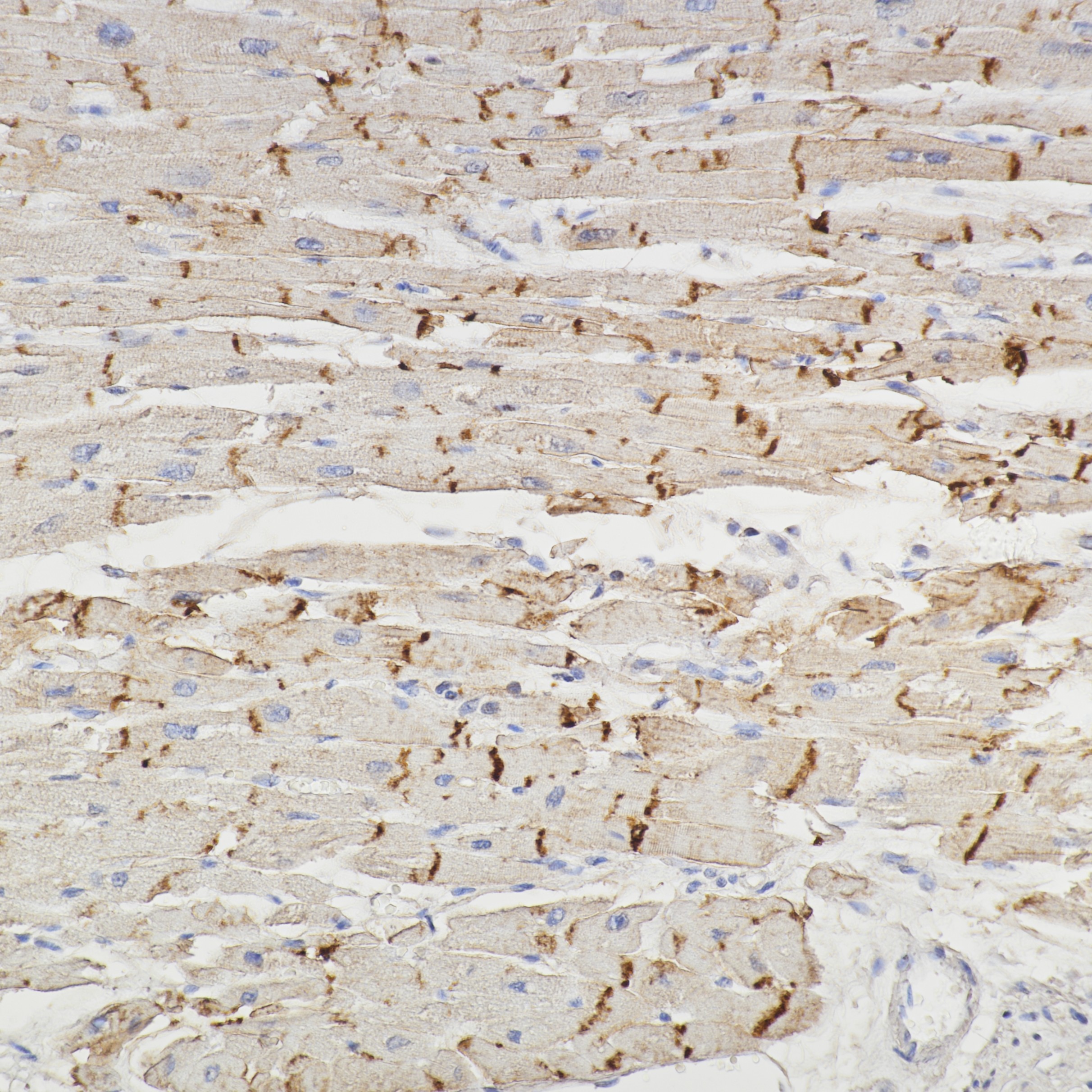 IHC staining of human heart using 82968-1-RR