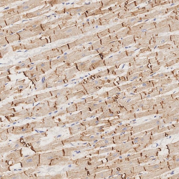 IHC staining of human heart using 82968-1-RR IHC staining of human heart using 82968-1-RR