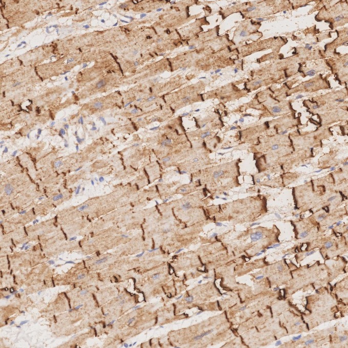IHC staining of human heart using 82968-1-RR IHC staining of human heart using 82968-1-RR