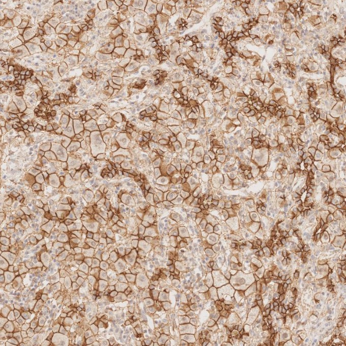 IHC staining of human liver using 82968-1-RR IHC staining of human liver using 82968-1-RR