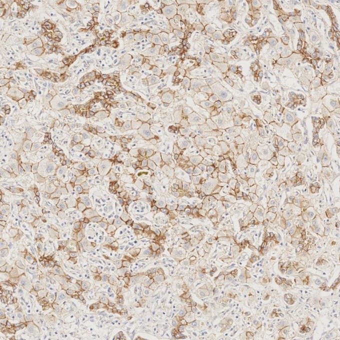 IHC staining of human liver using 82968-1-RR IHC staining of human liver using 82968-1-RR