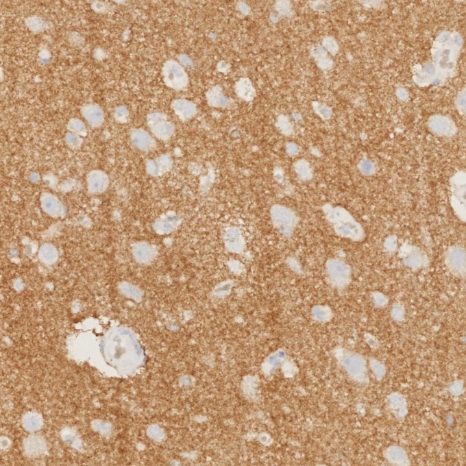 IHC staining of human brain using 82968-1-RR IHC staining of human brain using 82968-1-RR