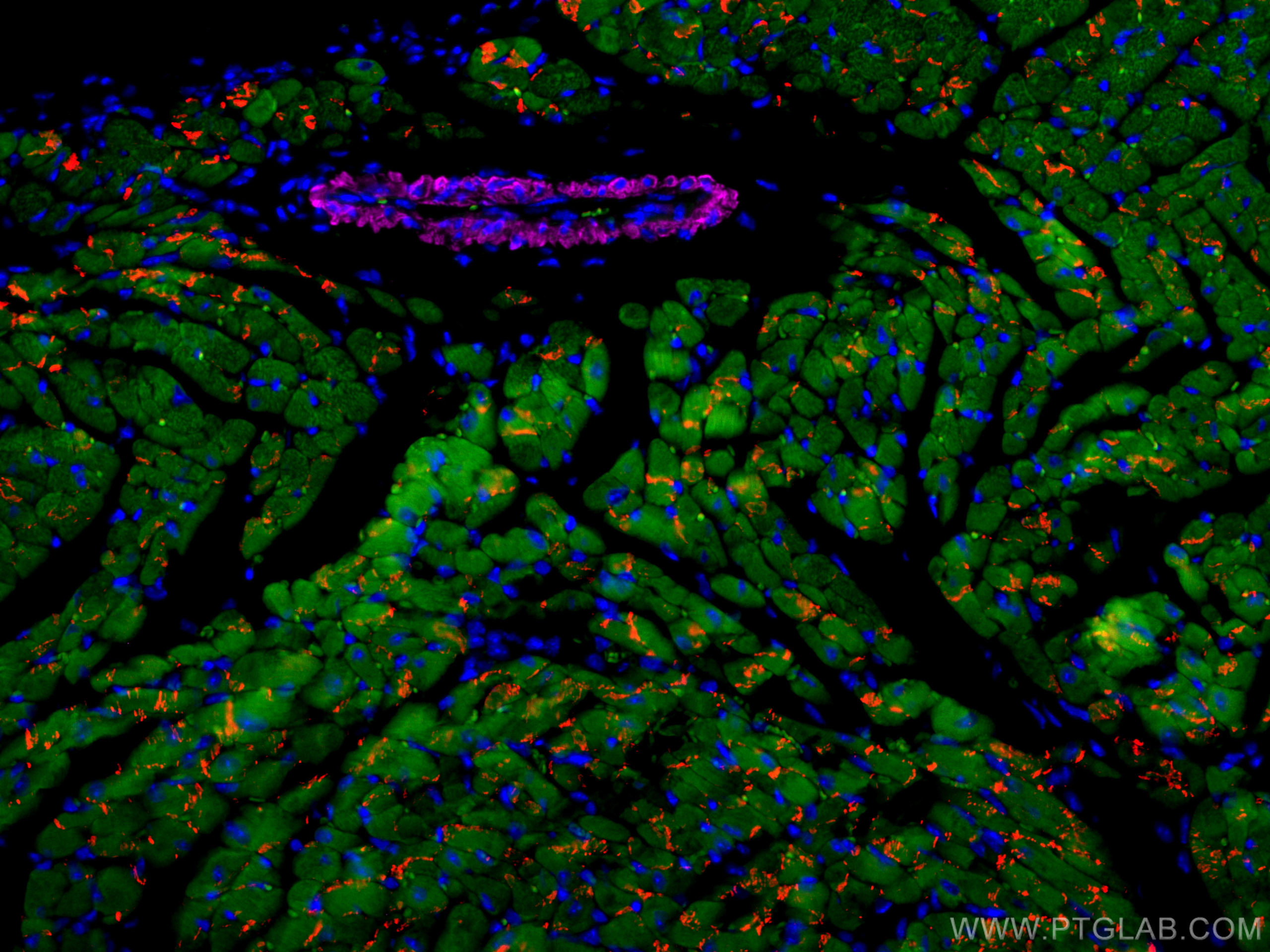 IF Staining of mouse heart using CL594-22018