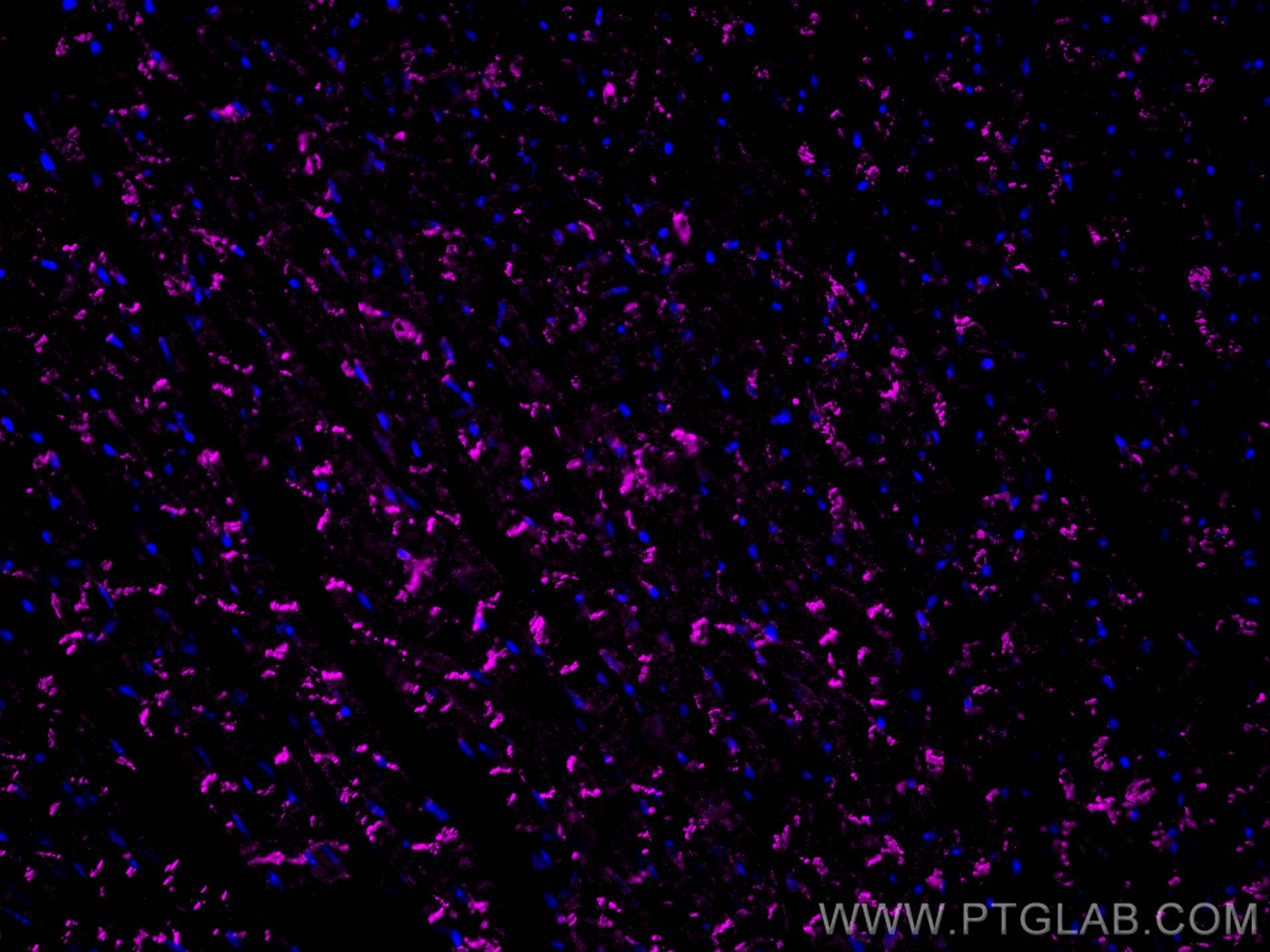 IF Staining of mouse heart using CL647-66219