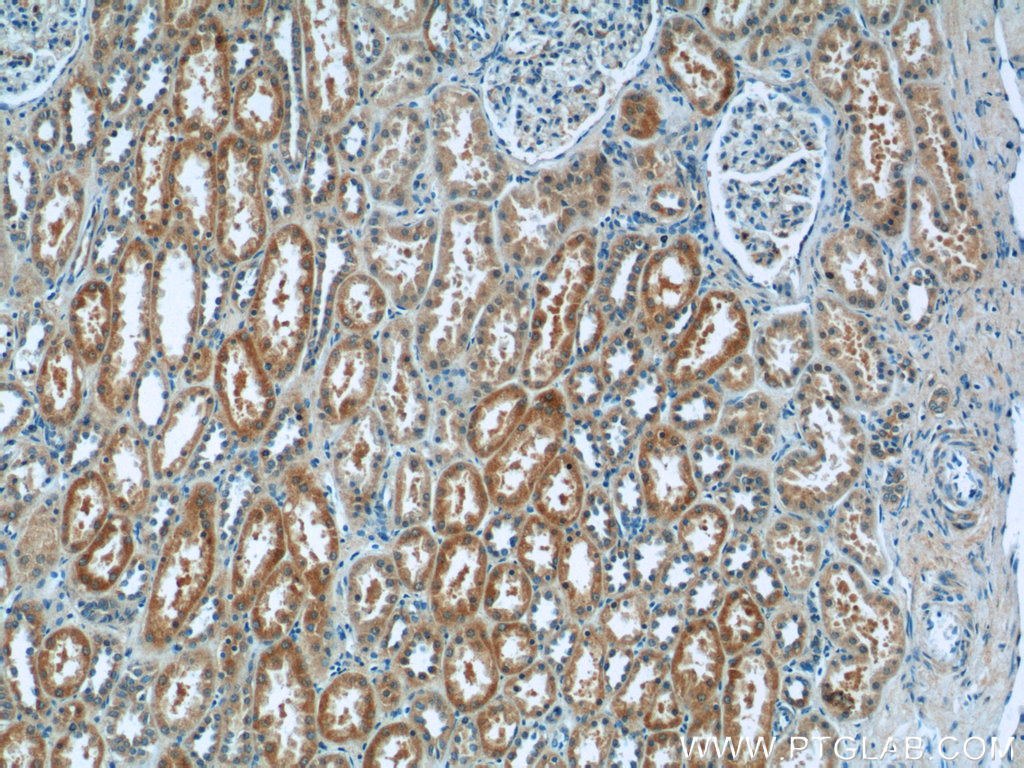 IHC staining of human kidney using 16733-1-AP