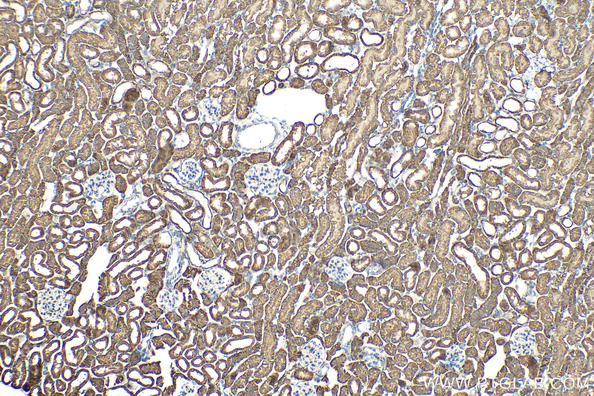 IHC staining of mouse kidney using 16733-1-AP