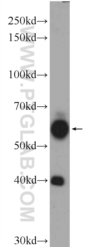 WB analysis of mouse brain using 16733-1-AP