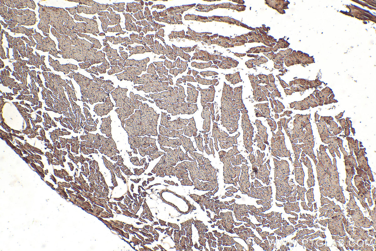 IHC staining of mouse heart using 16211-1-AP