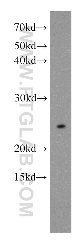 WB analysis of HEK-293 using 16211-1-AP