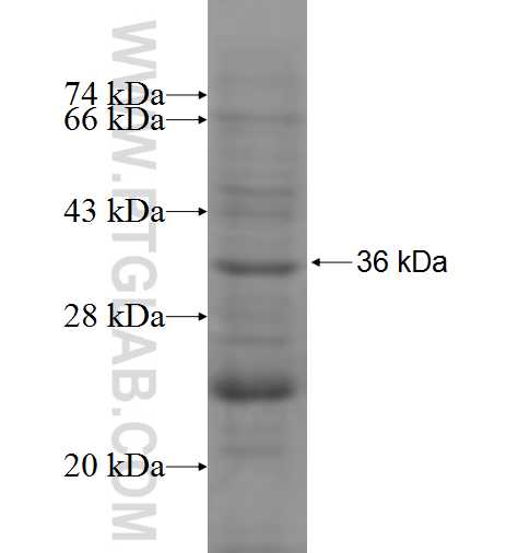 NAALAD2 fusion protein Ag7639 SDS-PAGE NAALAD2 fusion protein Ag7639 SDS-PAGE