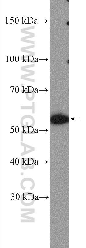 WB analysis of HepG2 using 18541-1-AP