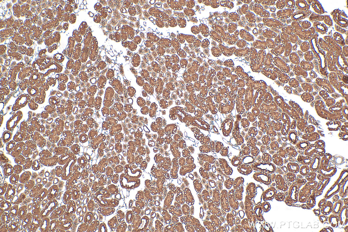 IHC staining of mouse kidney using 32235-1-AP