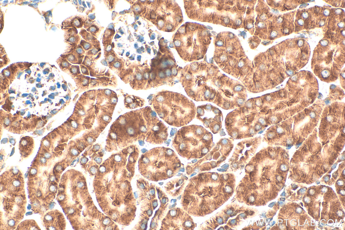 IHC staining of mouse kidney using 32235-1-AP