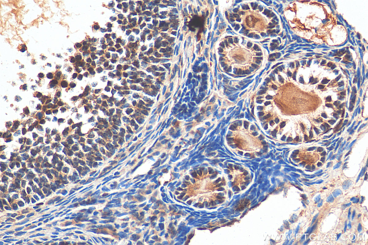 IHC staining of mouse ovary using 14551-1-AP