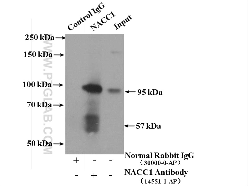 IP experiment of MCF-7 using 14551-1-AP