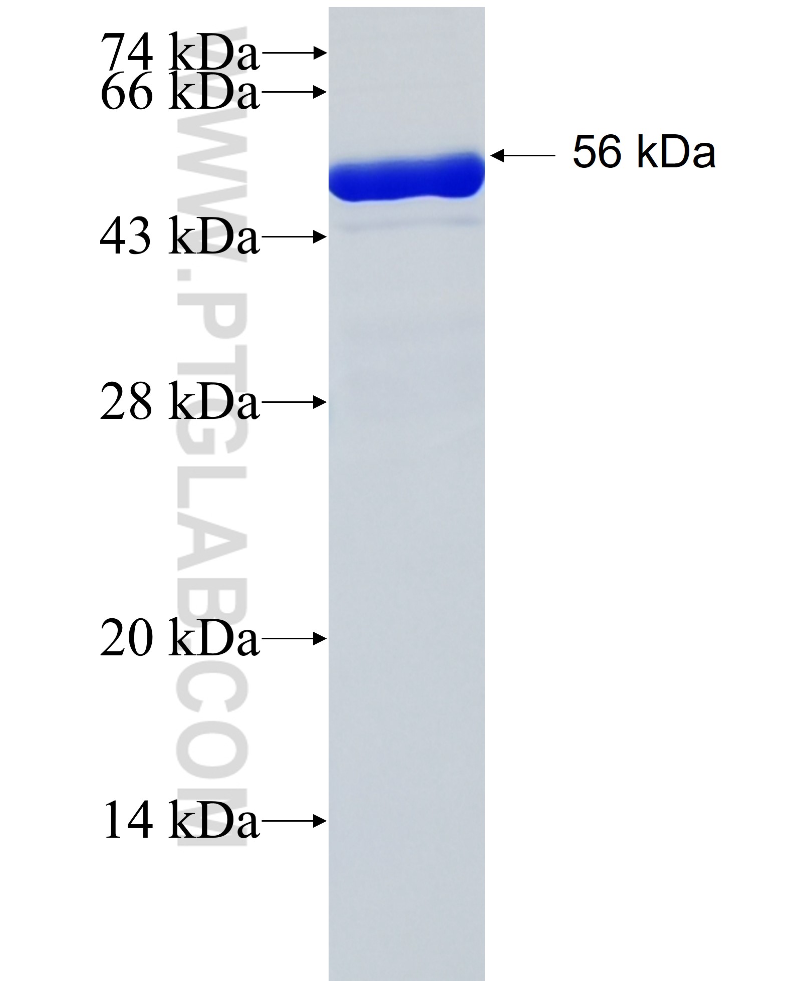 NACC2 fusion protein Ag26874 SDS-PAGE NACC2 fusion protein Ag26874 SDS-PAGE