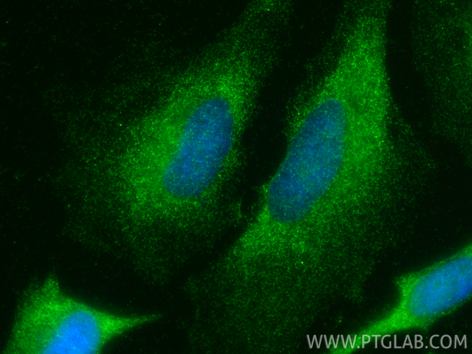 IF Staining of HeLa using 15548-1-AP