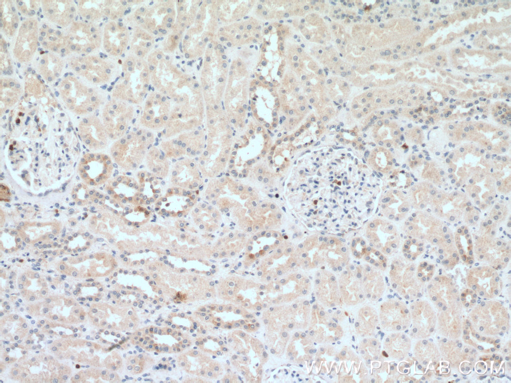 IHC staining of human kidney using 15548-1-AP