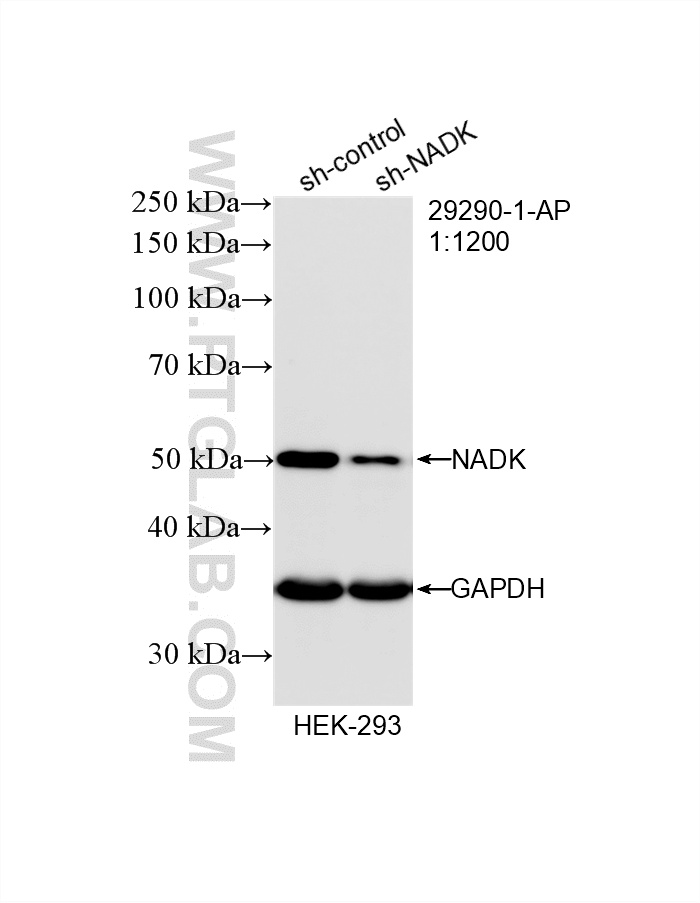 WB result of NADK antibody (29290-1-AP; 1:1200; incubated at room temperature for 1.5 hours) with sh-Control and sh-NADK transfected HEK-293 cells. WB analysis of HEK-293 using 29290-1-AP
